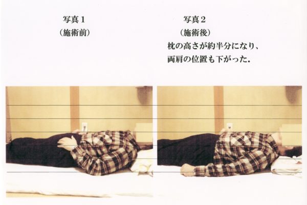 親日家オランダ人プロ指圧師に触手療法を2時間実演しました こくまい指圧院